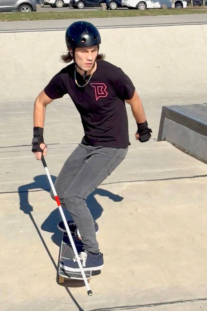 After losing his vision at 16, Brett Devloo refused to quit skateboarding. (Special to The Star)